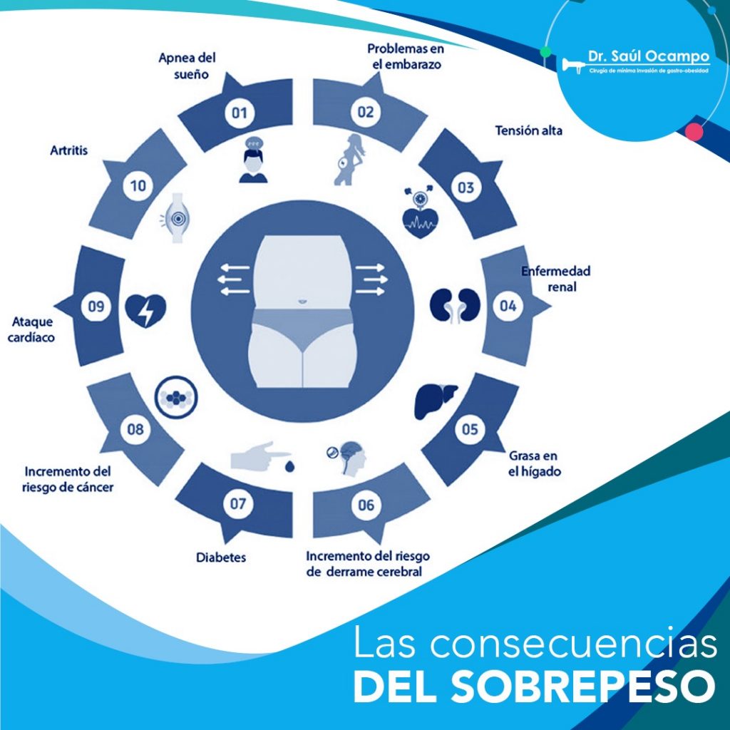 tratamiento de obesidad con enfermedades secundarias en Guadalajara